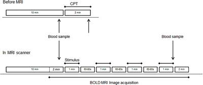 Brainstem Correlates of a Cold Pressor Test Measured by Ultra-High Field fMRI